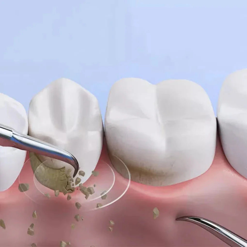 Lasergerät zur Entfernung von Nagelpilz