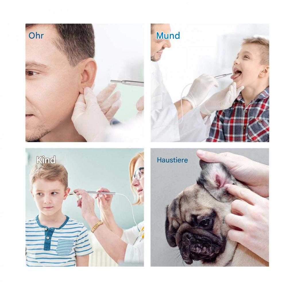 Digitales Otoskop mit 4,5-Zoll-Bildschirm